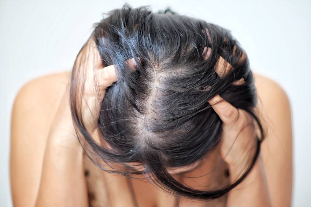 Thinning Hair? Top 5 Vitamins for Hair Growth